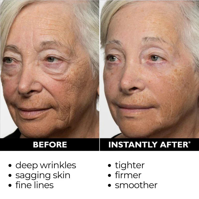 Orovita® Instant Skin Tightener